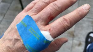 Permanent Fix